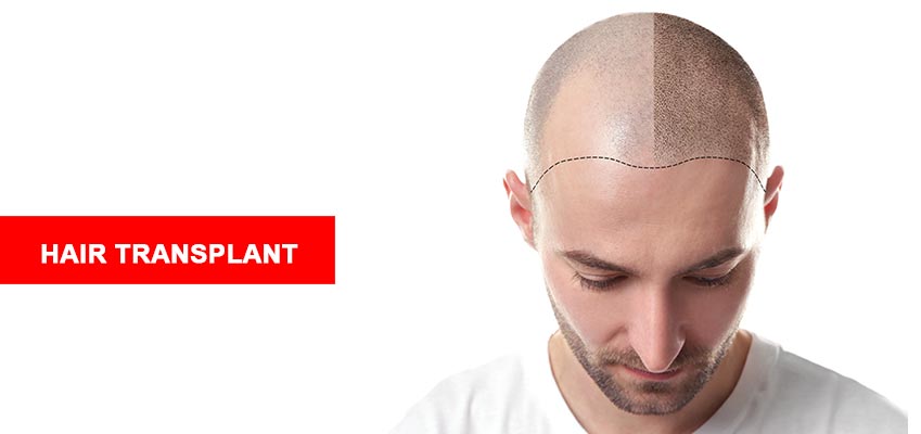 Hair Transplant Doctor In Jaipur