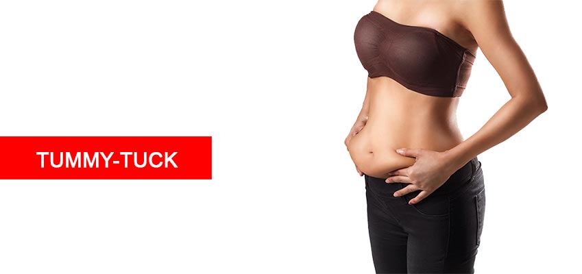 Tummy Tuck